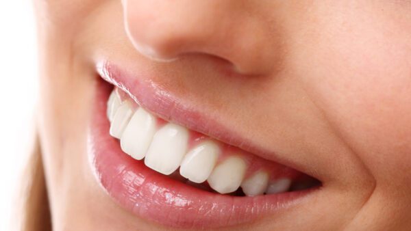 BOZO (LABIO SUPERIOR)