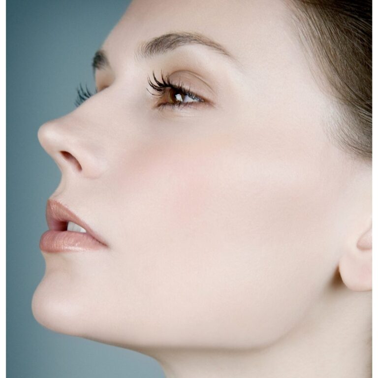 RINOMODELACIÓN CON ACIDO HIALURONICO