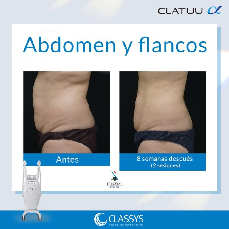 CRIOSHAPE - REDUCTIVO CORPORAL -