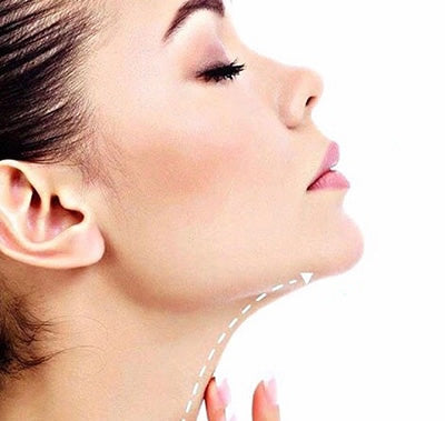 Lipólisis Enzimática para Papada – Reducción Sin Cirugía (3 Sesiones)