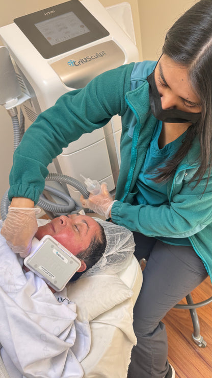 CrioLifting / Tensado de piel - eliminar papada