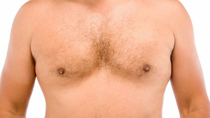 Criolipolisis 360 Clatuu