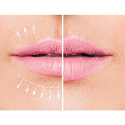 PERFILADO Y/O VOLUMINIZACION DE LABIOS