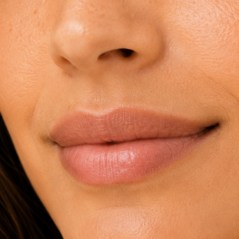 Labio Superior (bozo)