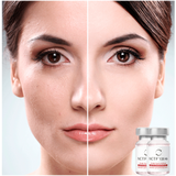 Mesoterapia NCTF 135HA – Cóctel de Vitaminas Facial