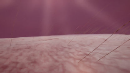SCULPTRA - BIOESTIMULADOR DE COLAGENO